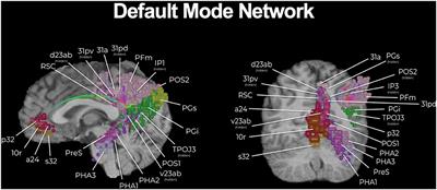 Reducing the Cognitive Footprint of Brain Tumor Surgery